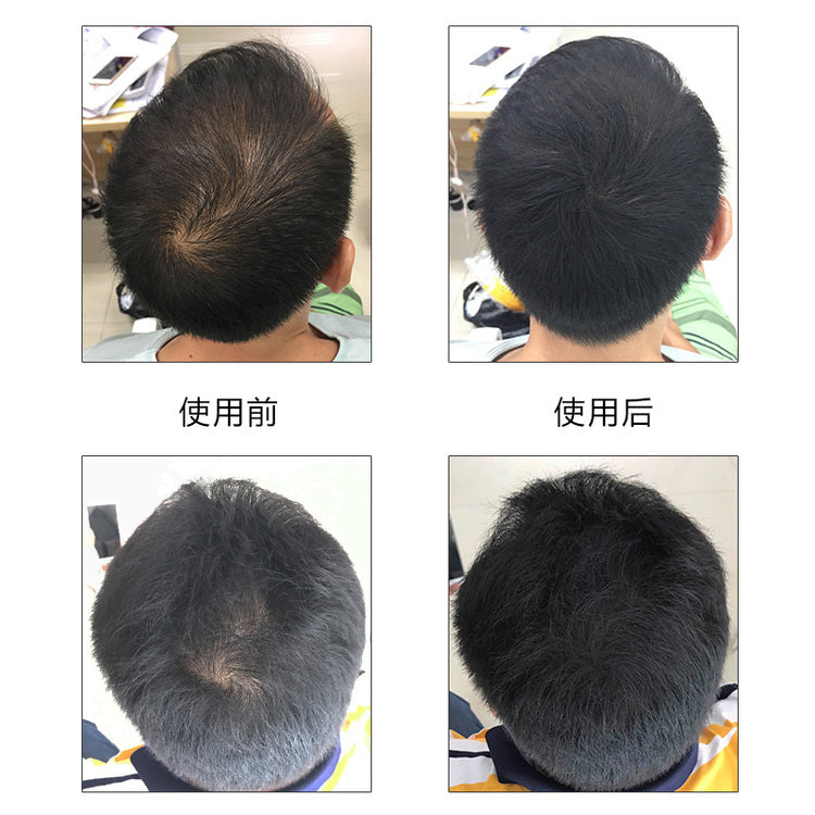 Kingyes Hair Fiber Spray