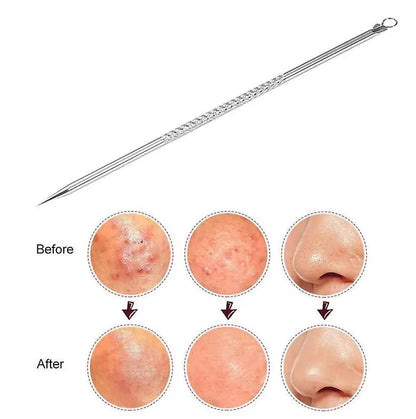 Blackhead Remover Tools My Store